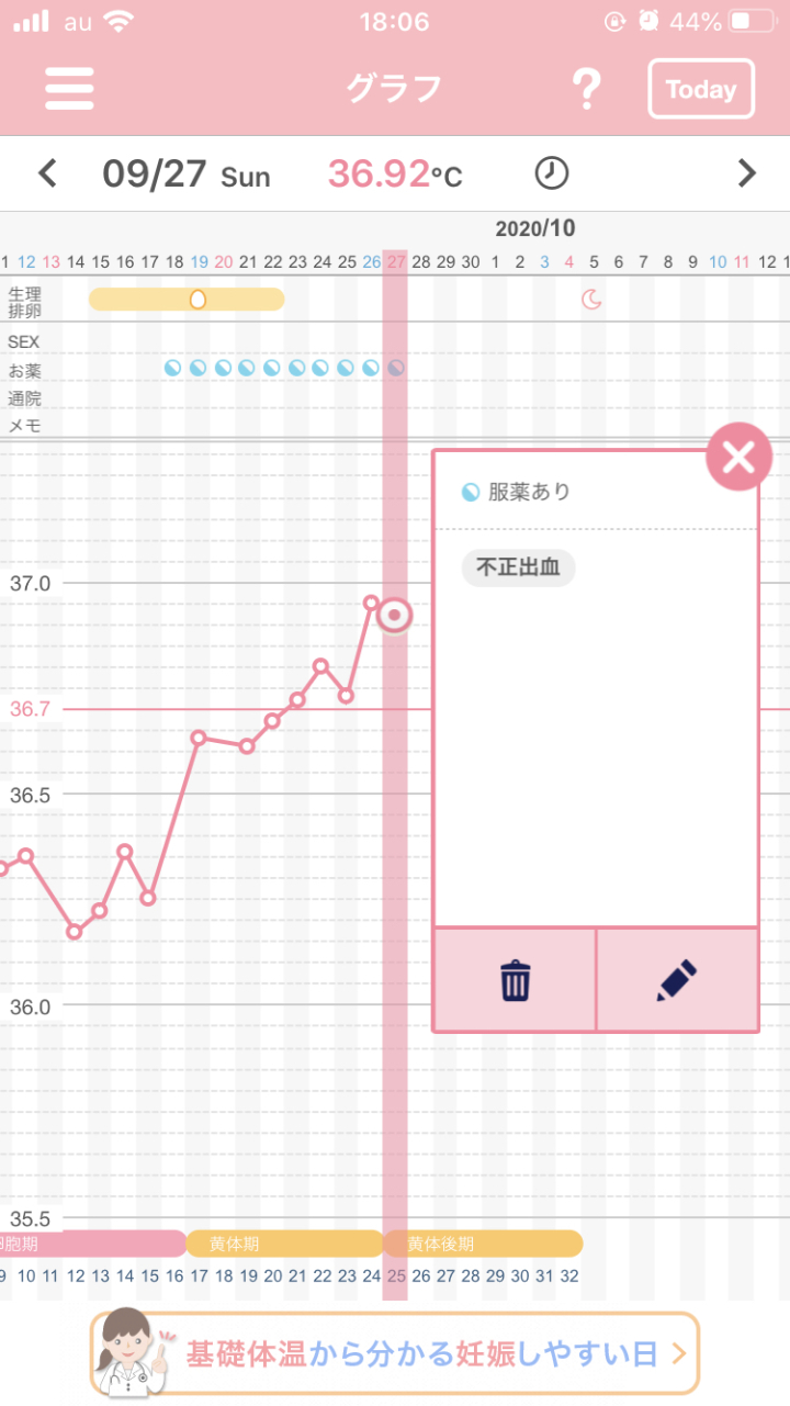 高温期10日目 胸の張り